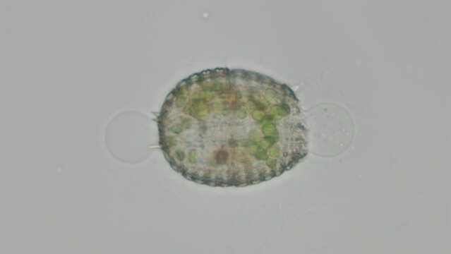 Coleps sp. ciliate at 50x under brightfield microscopy