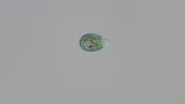 Coleps sp. ciliate and debris at 20x brightfield microscopy