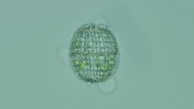 Coleps sp. ciliate cell detail at 50x brightfield microscopy