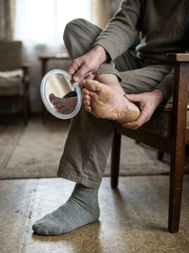 Senior man checking his foot sole with a mirror for skin conditions like calluses or diabetic ulcers
