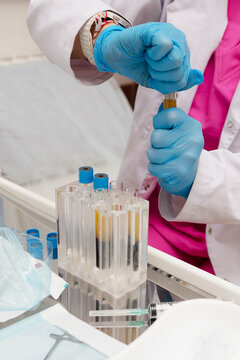 Blood plasma in tubes. Chemistry laboratory. Regenerative medicine. Lab technician holding test tube of blood sample after being centrifuged. Non-surgical procedures. Blood taken from patient