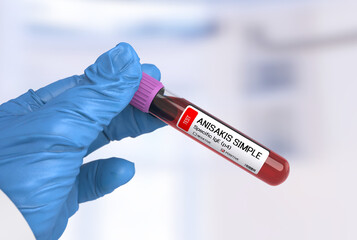 Obraz premium Doctor's hand wearing a glove, holding a blood test tube with a positive result for Anisakis IgE