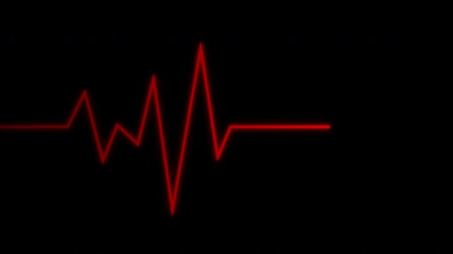 Heartbeat flatline, Cardiogram cardiograph. Suitable for medical presentations, educational materials, healthcare websites. Detailed ecg display concept for medical and technology design projects.