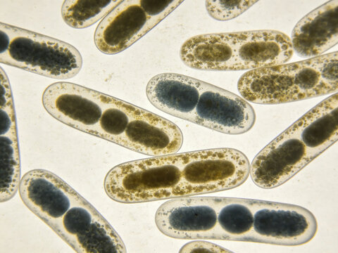 Original Gram-stained micrograph of Enterobacter cloacae, Gram-negative rods, clinical nosocomial isolate, natural staining unevenness