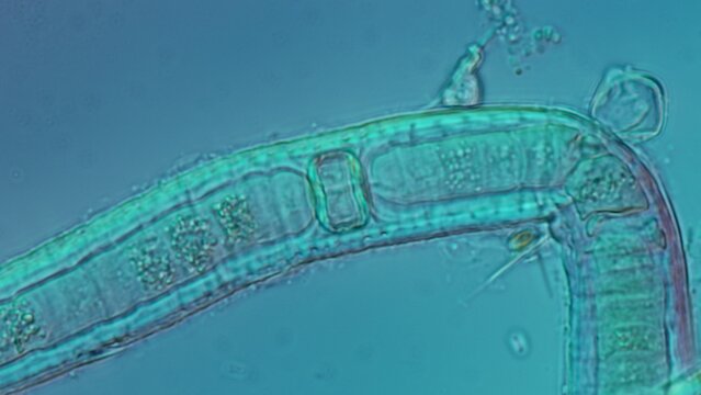Cyanobacteria heterocyst and filament at 50x in Nomarski DIC microscopy