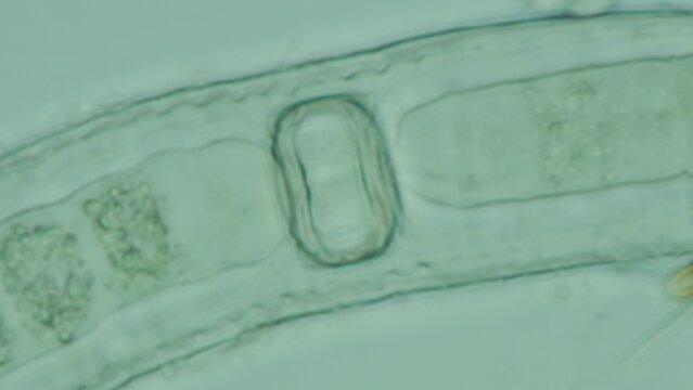 Cyanobacteria heterocyst close-up at 100x in brightfield microscopy