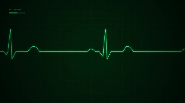 Green glowing heartbeat line on a dark monitor display with medical rhythm pattern