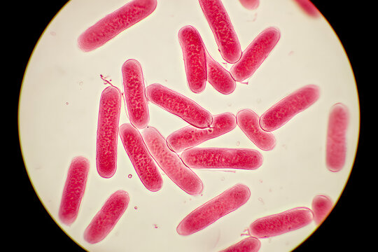 Gram Negative Rod Bacteria Pink Stained Under Light Microscope Circular View Bacillus Cells Microbiology Science Education