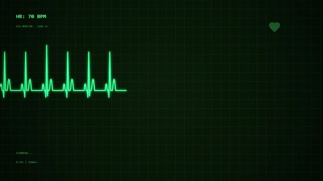 Digital heartbeat monitor displaying green electrocardiogram line on dark screen