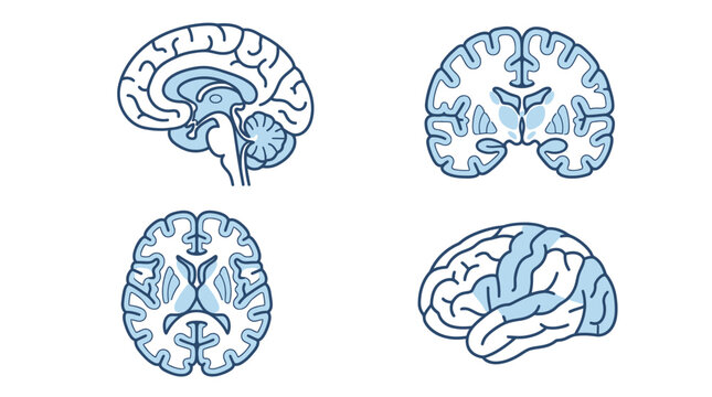 Medical diagrams showing different views of the human brain