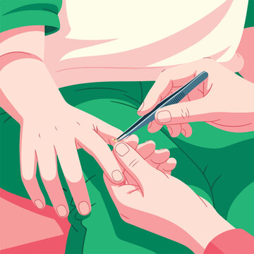Person removing splinter from another's finger with tweezers