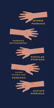 Types of Psoriasis Medical Infographic Banner with Affected Human Skin Arms