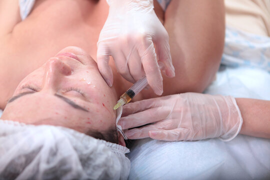 Plasmolifting procedure. Blood in test tube. Cosmetologist makes injections of plasmolifting. Close-up of patient's face is out of focus. Concept of cosmetology. Selective focus