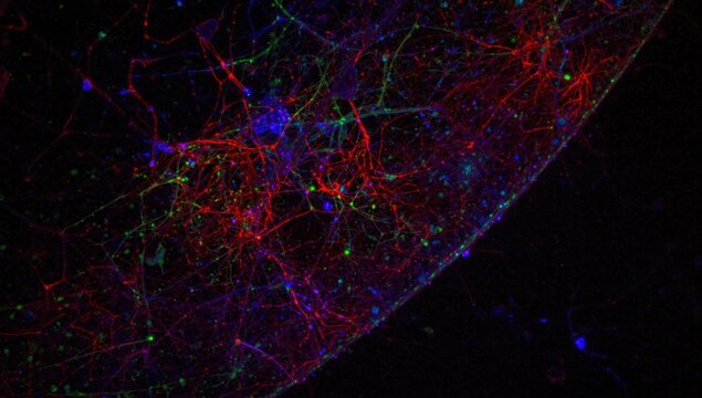 Visualization of mouse hippocampal CA1 neurons highlighted through immunofluorescence and confocal microscopy