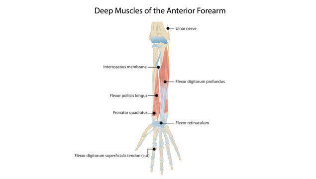 Deep Muscles of the Anterior Forearm, the deep flexor muscles of the anterior forearm, including flexor digitorum profundus, flexor pollicis longus, and pronator quadratus.