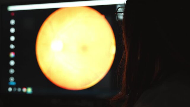 Medical professional analyzing digital retinal scan on computer