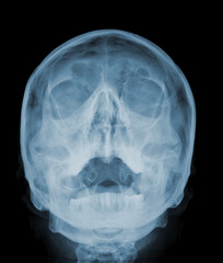 X-ray Skull Front View Medical Imaging Isolated on Transparent Background © MdRiyadull