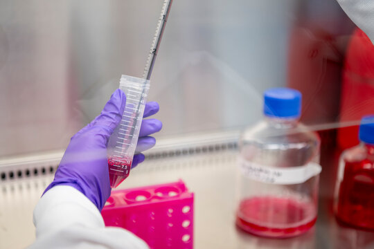 Scientist pipetting a sample in a laboratory