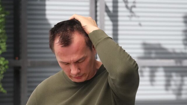 Stressed Middle Aged Asian man with Headache, Managing Stress and Finding Relief for Headache Pain, concept image for hair loss or stress management