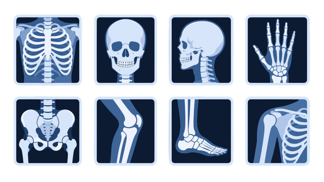 Set of human skeleton xray icons with skull, hand, pelvis and joints