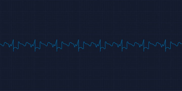 Emergency ekg monitoring. Blue glowing neon heart pulse. Heart beat. Electrocardiogram
