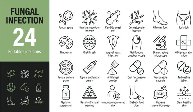 Fungal Infection Line Editable Icons set. Vector illustration in modern thin line style of dermatology and medical icons: athlete's foot, yeast, ringworm, antifungal medicine, and skin treatment.
