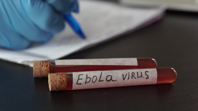ebola virus test tubes background laptop computer surface close up of scientist hands in gloves writing journal medical product concept of infectious disease laboratory, outbreak control, analysis