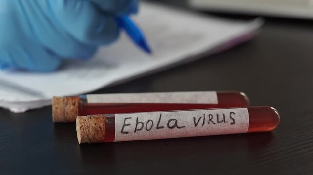 ebola virus test tubes background laptop computer surface close up of scientist hands in gloves writing journal medical product concept of infectious disease laboratory, outbreak control, analysis