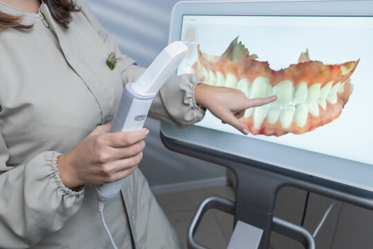 Las manos de dentista con scanner 3d de paciente bocal 