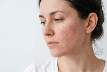 Fototapeta premium A woman is sitting still with her head turned to the side. She has noticeable skin texture and is in a simple indoor setting with plain walls. Natural light fills the area