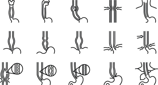 Medical illustration showing various esophageal conditions and disorders.