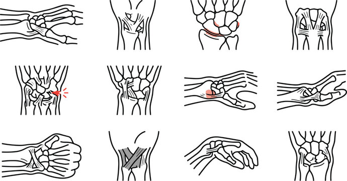 Anatomical diagrams of human wrist bones and ligaments showing various clinical perspectives.