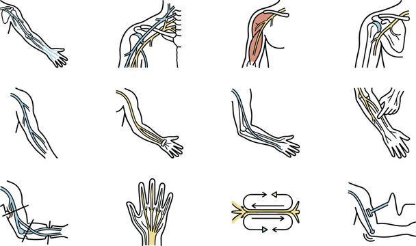 Set of anatomical diagrams illustrating human arm nerves and muscle structures.