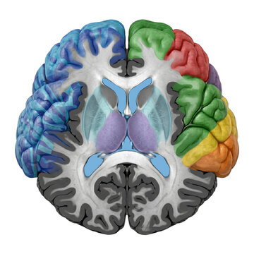 Brain Imaging Views