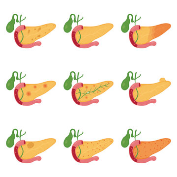 Pancreas Disease Medical Illustrations Set