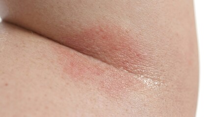 Fototapeta premium Closeup view of human skin texture on elbow area highlighting various skin tones imperfections and natural features with a smooth finish and subtle details visible in high resolution