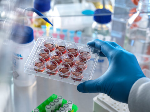 Scientist holding multi well plate with blood samples in fume hood