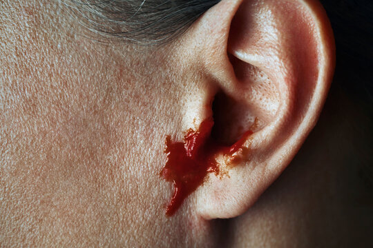 Close up of a bleeding human ear highlighting injury or fake news