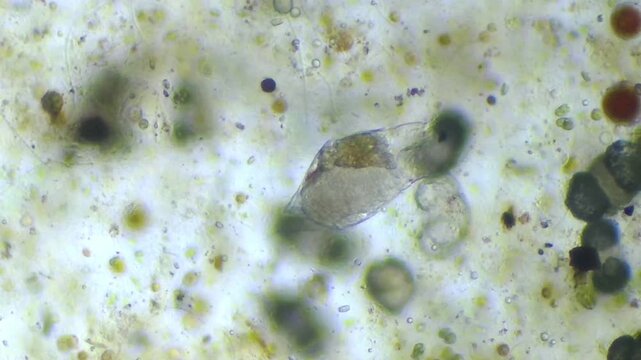 Microscopic close-up of an elongated transparent microorganism swimming among algae and organic matter