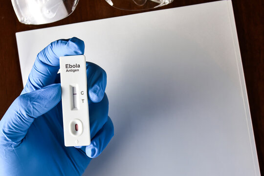 Gloved hand holding a negative Ebola antigen rapid test kit cassette in a medical laboratory or clinic setting, with copy space