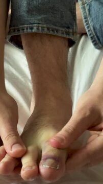 Close-up of hands inspecting and assessing the toes of a foot, showing detailed examination and care in a bright indoor setting with soft lighting
