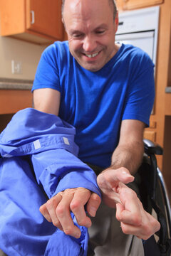 Man with Friedreich's Ataxia and deformed hands removing his Velcro shirt