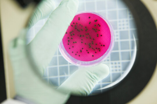 Scientist analyzing bacterial colonies