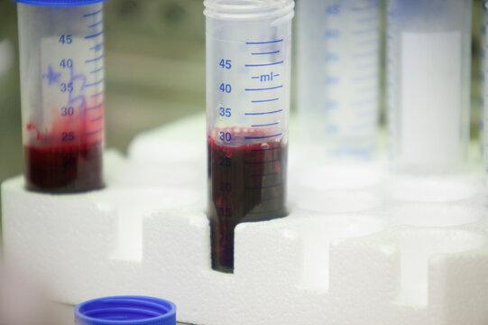 Close-up of blood samples in vials in a laboratory