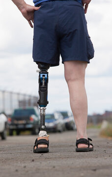 Woman with prosthetic leg standing on the road