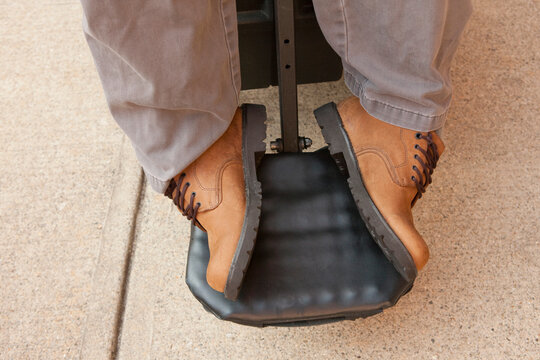 Degenerated feet of a man in a wheelchair with Duchenne muscular dystrophy