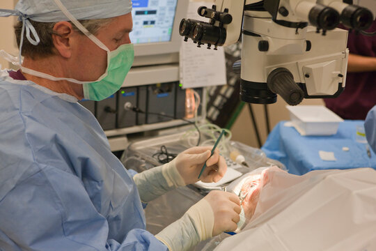 Doctor using a blade on cateract patient preparing to make incision