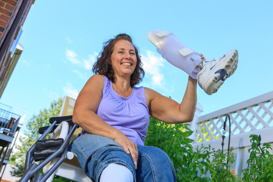 Woman with Spina Bifida showing off new leg brace