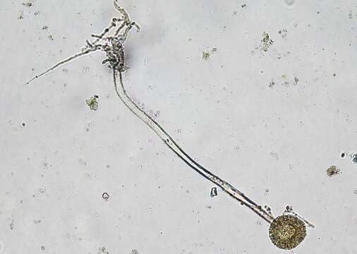 soil microorganisms under a microscope including amoeba, flagellates, nematodes, fungi, bacteria	