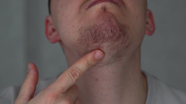 Close-up of a beard on a fair-skinned man